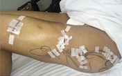 “Tình một đêm” của Ronaldo có thể phải cưa chân “Tình một đêm” của Ronaldo có thể phải cưa chân
