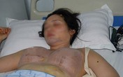 Vợ nâng ngực, chồng không dám sờ vì sợ... nổ! Vợ nâng ngực, chồng không dám sờ vì sợ... nổ!