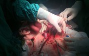 Những hình ảnh lần đầu công bố về ca ghép tạng xuyên Việt Những hình ảnh lần đầu công bố về ca ghép tạng xuyên Việt