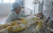 Nước mắt ân hận, day dứt của người mẹ có con 6 tuổi bỏng nặng do nấu cám lợn Nước mắt ân hận, day dứt của người mẹ có con 6 tuổi bỏng nặng do nấu cám lợn