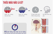 Phòng và điều trị thiếu máu não Phòng và điều trị thiếu máu não