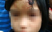 Giải cứu bé gái bị nhốt trong ngôi nhà cũ Giải cứu bé gái bị nhốt trong ngôi nhà cũ