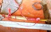 Nghi vợ ngoại tình, chồng chích điện, rượt chém vợ Nghi vợ ngoại tình, chồng chích điện, rượt chém vợ