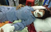 Hé lộ nguyên nhân người chồng cắt gân tay, gân chân vợ ở Bắc Giang Hé lộ nguyên nhân người chồng cắt gân tay, gân chân vợ ở Bắc Giang
