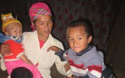 Mẹ nghiện thuốc lá, con dễ khoèo chân Mẹ nghiện thuốc lá, con dễ khoèo chân