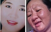 Thai phụ mang họa vì tự ý dùng thuốc dị ứng Thai phụ mang họa vì tự ý dùng thuốc dị ứng