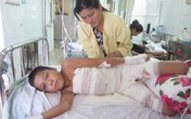 Gia cảnh đáng thương của cậu bé bị bỏng nặng phải cắt bỏ bộ phận sinh dục Gia cảnh đáng thương của cậu bé bị bỏng nặng phải cắt bỏ bộ phận sinh dục