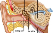 Nguy cơ suy giảm thính lực do viêm tai giữa Nguy cơ suy giảm thính lực do viêm tai giữa