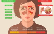 Bài thuốc đông y cổ truyền, liệu pháp trị viêm xoang hiệu quả Bài thuốc đông y cổ truyền, liệu pháp trị viêm xoang hiệu quả