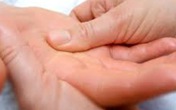 Hỏi-đáp thuốc chữa bệnh ra mồ hôi tay chân Hỏi-đáp thuốc chữa bệnh ra mồ hôi tay chân