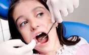Sâu răng nguy hiểm không kém bệnh ung thư Sâu răng nguy hiểm không kém bệnh ung thư