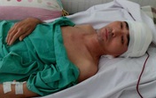 Diễn viên "Người đẹp Tây Đô" ghép hộp sọ thành công Diễn viên "Người đẹp Tây Đô" ghép hộp sọ thành công