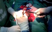 Nam thanh niên gãy 'súng' vì thử tư thế mới Nam thanh niên gãy 'súng' vì thử tư thế mới