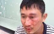 "Đại gia" quỵt 30 ngàn tiền giao hàng và đánh shipper gãy mũi "Đại gia" quỵt 30 ngàn tiền giao hàng và đánh shipper gãy mũi