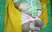 Bé trai sơ sinh có cân nặng "khủng" 5,1kg Bé trai sơ sinh có cân nặng "khủng" 5,1kg