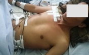 Sống sót kỳ lạ sau cú rơi 3m và bị bê tông đè Sống sót kỳ lạ sau cú rơi 3m và bị bê tông đè