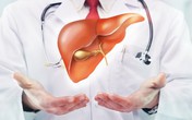 Những “sát thủ” thầm lặng gây bệnh gan có thể bạn mắc mà không biết Những “sát thủ” thầm lặng gây bệnh gan có thể bạn mắc mà không biết
