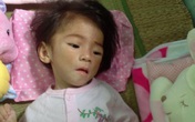Hành trình đặc biệt cứu giúp bé 14 tháng nặng 3,5 kg