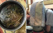 Mặt “nở hoa” vì xông hơi rau gia vị sai cách Mặt “nở hoa” vì xông hơi rau gia vị sai cách