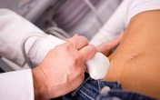 Buồng trứng đa nang là gì? Buồng trứng đa nang là gì?