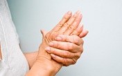 Dấu hiệu sớm cảnh báo bệnh ung thư phổi thường bị bỏ qua Dấu hiệu sớm cảnh báo bệnh ung thư phổi thường bị bỏ qua