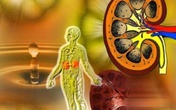 Những thói quen dễ gây hỏng thận Những thói quen dễ gây hỏng thận