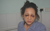 Giây phút kinh hãi của cô gái bị bạn trai là thiếu uý công an đánh chấn thương sọ não Giây phút kinh hãi của cô gái bị bạn trai là thiếu uý công an đánh chấn thương sọ não