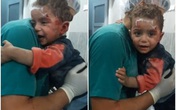 Đau lòng trước hình ảnh cậu bé Syria người đầy máu tuyệt vọng ôm chặt lấy y tá Đau lòng trước hình ảnh cậu bé Syria người đầy máu tuyệt vọng ôm chặt lấy y tá