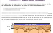 Thực hư việc “sau 15 phút trẻ ra… 5 - 10 tuổi” Thực hư việc “sau 15 phút trẻ ra… 5 - 10 tuổi”