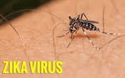Tập huấn cập nhật siêu âm chẩn đoán và theo dõi tật đầu nhỏ ở thai nhi do Zika Tập huấn cập nhật siêu âm chẩn đoán và theo dõi tật đầu nhỏ ở thai nhi do Zika