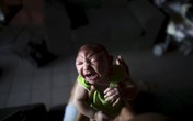 TP.HCM: Thai phụ mắc Zika sinh con ra sao? TP.HCM: Thai phụ mắc Zika sinh con ra sao?