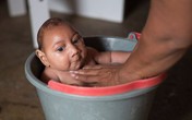 Virus Zika gây dị tật đầu nhỏ ở trẻ đã xâm nhập hàng chục nước Virus Zika gây dị tật đầu nhỏ ở trẻ đã xâm nhập hàng chục nước