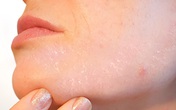 10 dấu hiệu tưởng bình thường của cơ thể nhưng báo hiệu nguy hại 10 dấu hiệu tưởng bình thường của cơ thể nhưng báo hiệu nguy hại