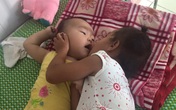 Xót xa em bé bụ bẫm, đáng yêu nhưng không thể ngóc được cổ lên Xót xa em bé bụ bẫm, đáng yêu nhưng không thể ngóc được cổ lên