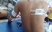 Thanh Hóa: 3 thanh niên bị nhóm người bịt mặt bắn trọng thương Thanh Hóa: 3 thanh niên bị nhóm người bịt mặt bắn trọng thương