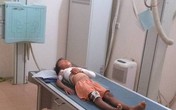 Cắt thi đua, kiểm điểm Hiệu trưởng nói không có trách nhiệm với học sinh bị cổng trường đè gãy vai Cắt thi đua, kiểm điểm Hiệu trưởng nói không có trách nhiệm với học sinh bị cổng trường đè gãy vai