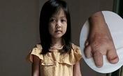 Nghẹn lòng bé gái 5 tuổi với ước mơ được... mặc quần dài Nghẹn lòng bé gái 5 tuổi với ước mơ được... mặc quần dài