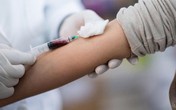 Lợi ích to lớn từ tư vấn xét nghiệm HIV tại cộng đồng Lợi ích to lớn từ tư vấn xét nghiệm HIV tại cộng đồng