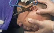 Nam Định: Hãi hùng cảnh bé trai 2 tuổi bị kéo đâm sâu vào tai Nam Định: Hãi hùng cảnh bé trai 2 tuổi bị kéo đâm sâu vào tai