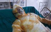 Cảnh cùng cực của người đàn ông mất nhà vì mưa lũ, giờ lại nguy kịch vì bỏng điện Cảnh cùng cực của người đàn ông mất nhà vì mưa lũ, giờ lại nguy kịch vì bỏng điện