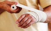 Những cách sơ cứu đơn giản cần biết khi bị bỏng Những cách sơ cứu đơn giản cần biết khi bị bỏng