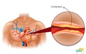 Cholesterol không xấu như ta nghĩ Cholesterol không xấu như ta nghĩ