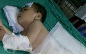 Cả nhà ăn Tết trong bệnh viện vì một phút bất cẩn Cả nhà ăn Tết trong bệnh viện vì một phút bất cẩn