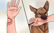 Dính “án tử” vì sai lầm khi chữa bệnh dại Dính “án tử” vì sai lầm khi chữa bệnh dại