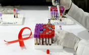 “HIV sẽ không bao giờ bị loại trừ nếu không có nghiên cứu khoa học” “HIV sẽ không bao giờ bị loại trừ nếu không có nghiên cứu khoa học”