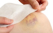 Dấu hiệu cảnh báo ung thư máu bạn thờ ơ bỏ qua mà không hay biết Dấu hiệu cảnh báo ung thư máu bạn thờ ơ bỏ qua mà không hay biết
