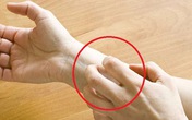 Các dấu hiệu cơ thể bị nhiễm độc và cách giải độc cho nội tạng đơn giản ai cũng làm được Các dấu hiệu cơ thể bị nhiễm độc và cách giải độc cho nội tạng đơn giản ai cũng làm được