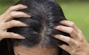 Đừng xem nhẹ, tóc bạc sớm cũng là dấu hiệu cảnh báo hàng loạt vấn đề sức khỏe Đừng xem nhẹ, tóc bạc sớm cũng là dấu hiệu cảnh báo hàng loạt vấn đề sức khỏe