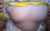Bố mẹ phát hoảng khi con gái 5 tháng tuổi dậy thì như thiếu nữ vì món ăn hằng ngày Bố mẹ phát hoảng khi con gái 5 tháng tuổi dậy thì như thiếu nữ vì món ăn hằng ngày