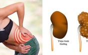 Để thận khỏe mạnh, không lo suy thận và chạy thận, bạn đừng bao giờ làm những điều này Để thận khỏe mạnh, không lo suy thận và chạy thận, bạn đừng bao giờ làm những điều này